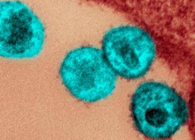 بیمار ژنو نخستین مبتلا به اچ آی وی که پس از پیوند سلول بنیادی طبیعی عفونتش فروکش کرد