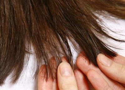 15 نکته برای افزایش رشد موی سر